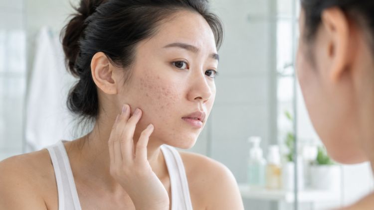 Điều trị sẹo kết hợp cải thiện da cần đúng mục tiêu