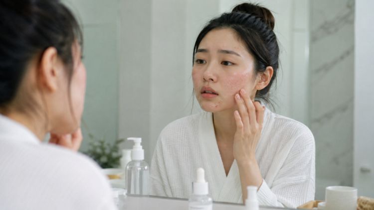 Da đang đỏ rát, viêm hoặc tổn thương cần được ổn định trước khi ưu tiên mục tiêu căng bóng