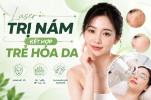 Laser Trị Nám Kết Hợp Trẻ Hóa Da: Cách Phối Hợp | Citrine