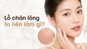 Lỗ Chân Lông To Nên Làm Gì? Cách Cải Thiện | Citrine