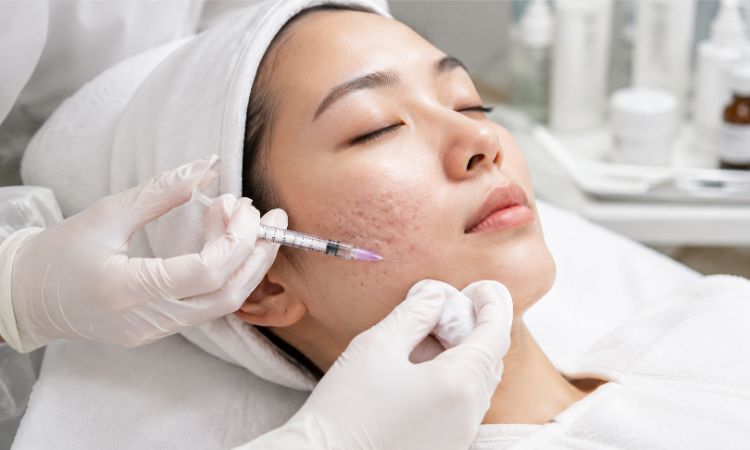 Meso hỗ trợ độ ẩm, bề mặt và phục hồi da sau mụn