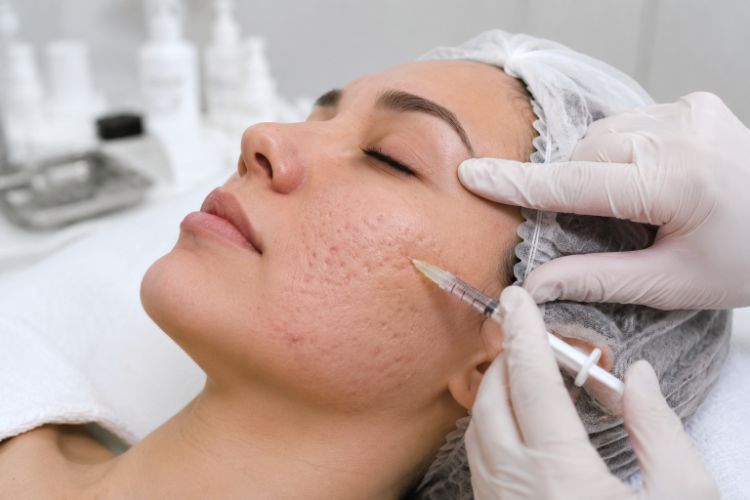 Những phản ứng sau Meso cần được theo dõi