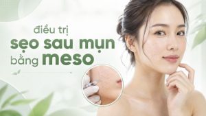 Điều Trị Sẹo Sau Mụn Bằng Meso Có Hiệu Quả Không?