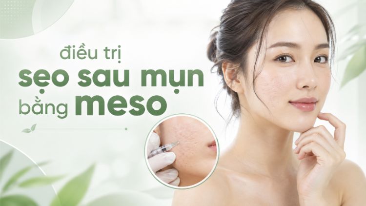 Điều Trị Sẹo Sau Mụn Bằng Meso Có Hiệu Quả Không?