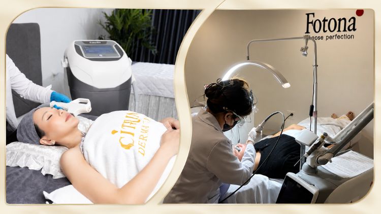 Phối hợp điều trị mụn và thâm theo từng giai đoạn da