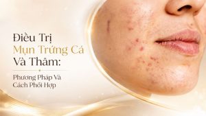 Điều Trị Mụn Trứng Cá Và Thâm: Các Phương Pháp | Citrine