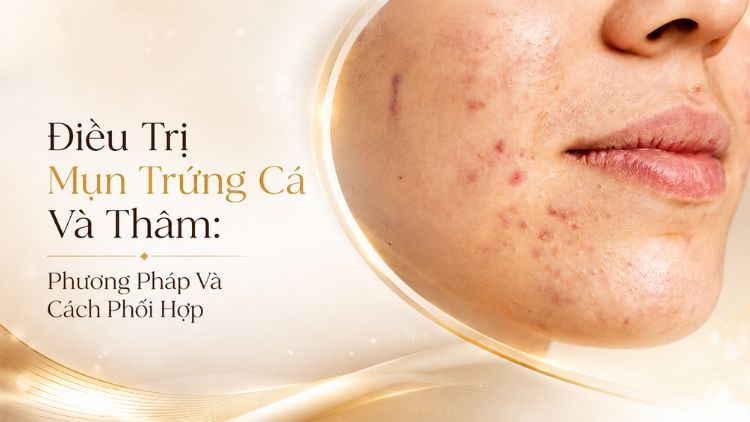 Điều Trị Mụn Trứng Cá Và Thâm: Các Phương Pháp | Citrine