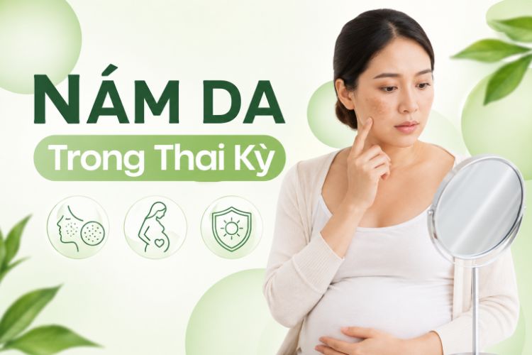 Nám Da Trong Thai Kỳ: Nguyên Nhân Và Cách Chăm Sóc