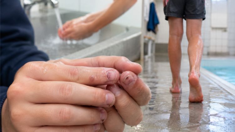 Những nhóm có nguy cơ xuất hiện mụn cóc cao hơn