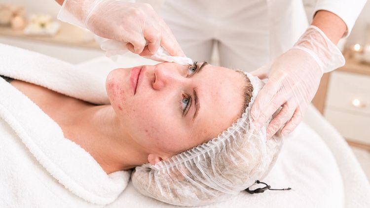 Phương pháp công nghệ cao hỗ trợ kiểm soát mụn và cải thiện tổn thương sau mụn