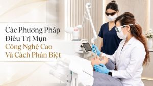 5 Phương Pháp Điều Trị Mụn Công Nghệ Cao: So Sánh | Citrine