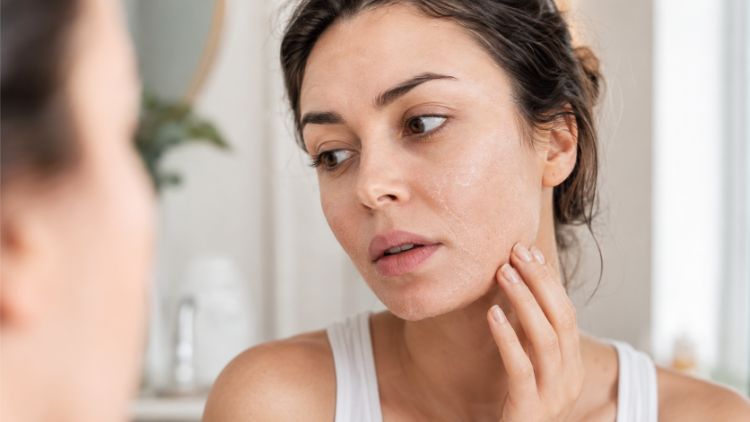 Da khô thiếu ẩm có thể làm nếp nhỏ biểu hiện rõ hơn