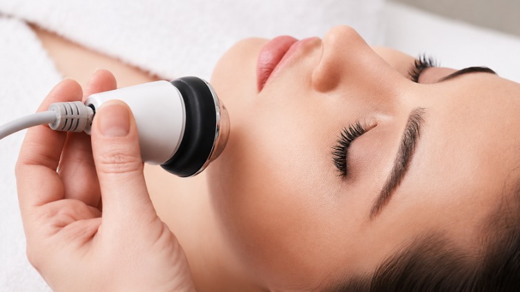 Trẻ hóa mặt bằng công nghệ siêu âm tại vùng cằm và đường viền hàm