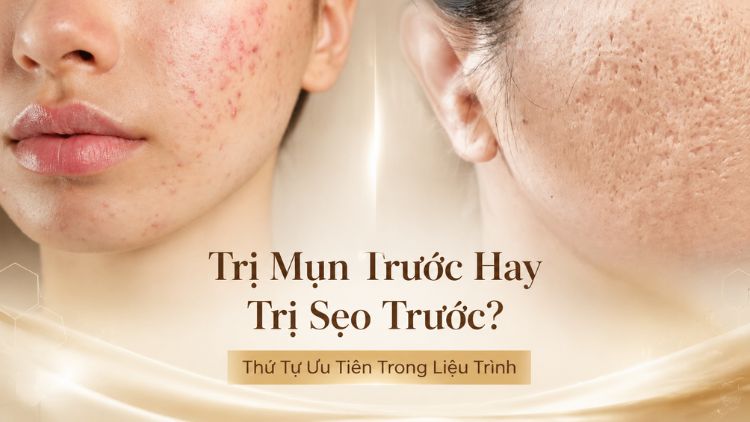 Trị mụn trước hay trị sẹo trước? Ưu tiên nào | Citrine