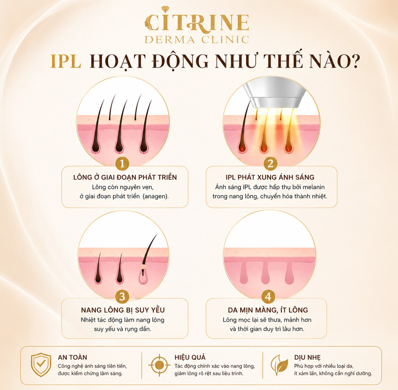 triệt lông ipl