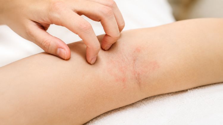 Bác sĩ cần đánh giá kỹ trước khi chỉ định tiêm meso