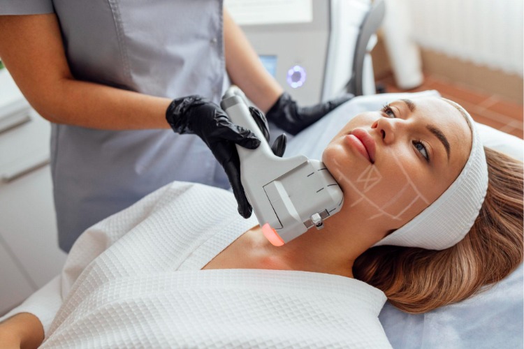 Xóa nọng cằm bằng sóng siêu âm đa tầng