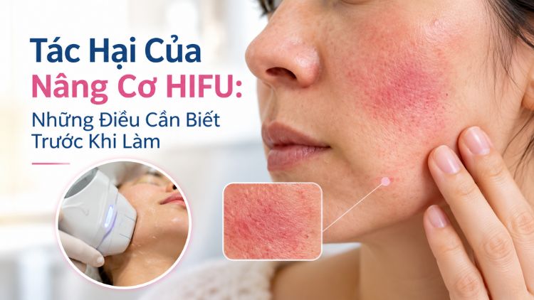Tác Hại Của Nâng Cơ HIFU: Những Điều Cần Biết Trước Khi Làm