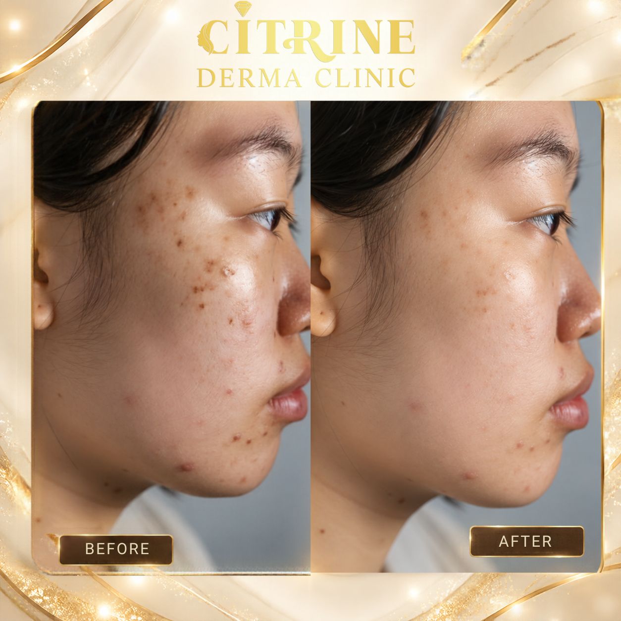Peel da có tốt không