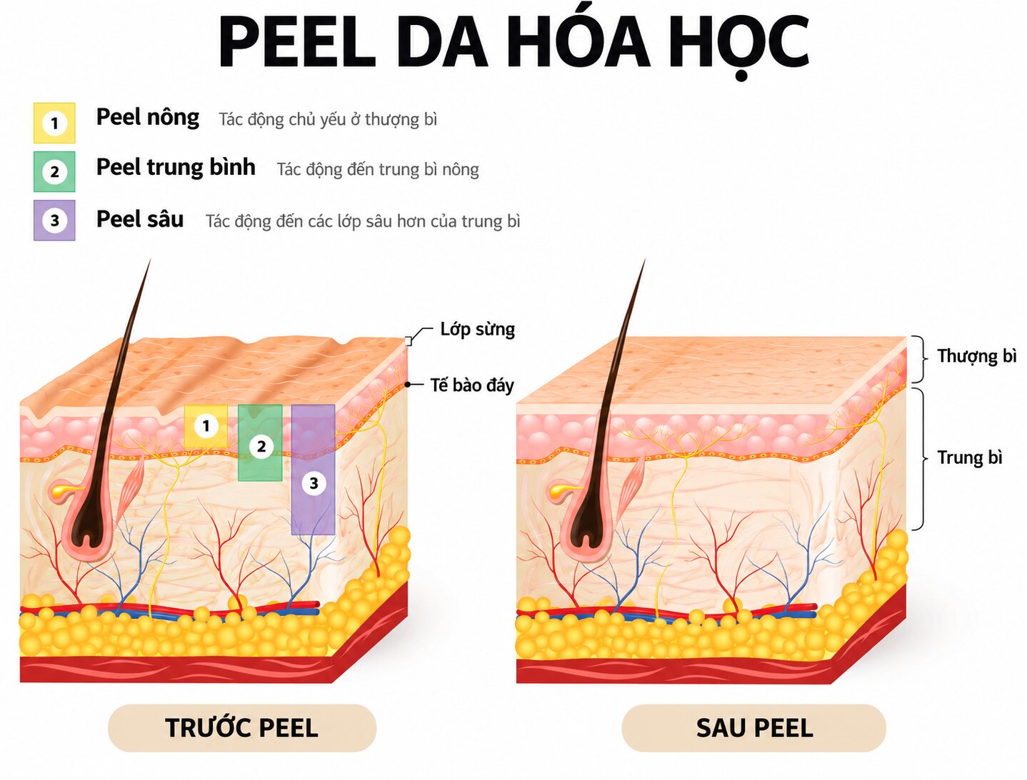 Peel da có tốt không